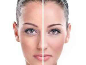 Plastic Surgery