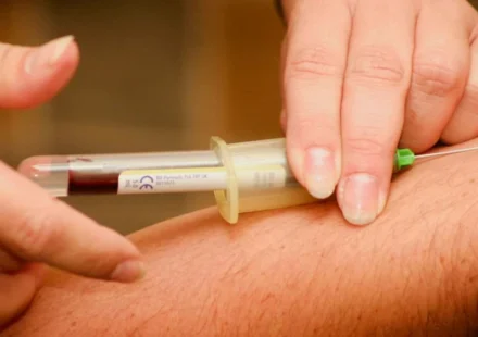 Blood sample collected from a patient's arm for early Alzheimer's disease screening and research testing